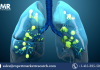 Acute Respiratory Syndrome Treatment Market