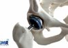 Orthopaedic Digit Implants Market