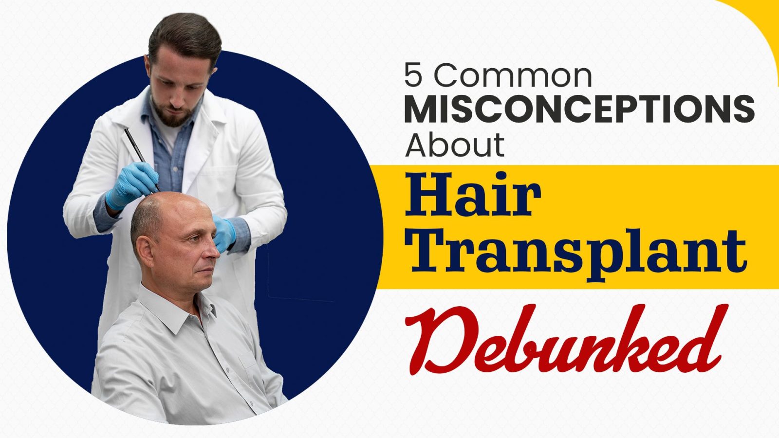 5 Common Misconceptions about Hair Transplants Debunked Daily