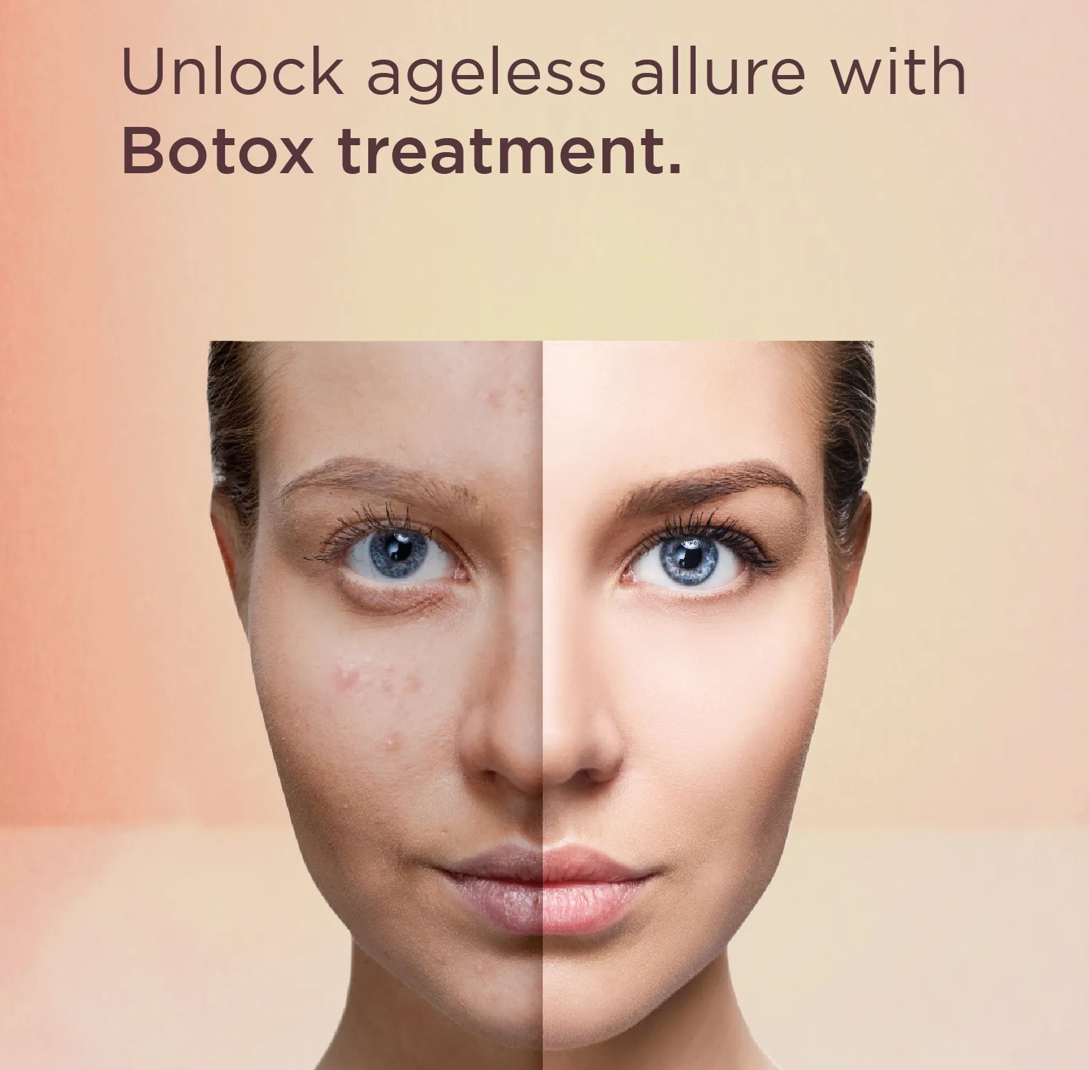 Botox Face Treatment