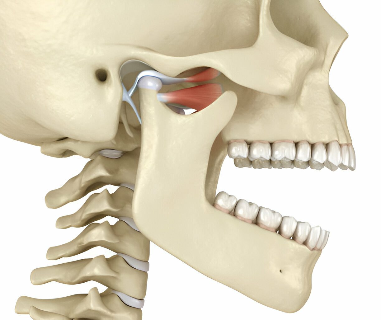 Effective TMJ Treatment in Lubbock, TX: How Lubbock Dental Care Can Help Alleviate Jaw Pain_FI