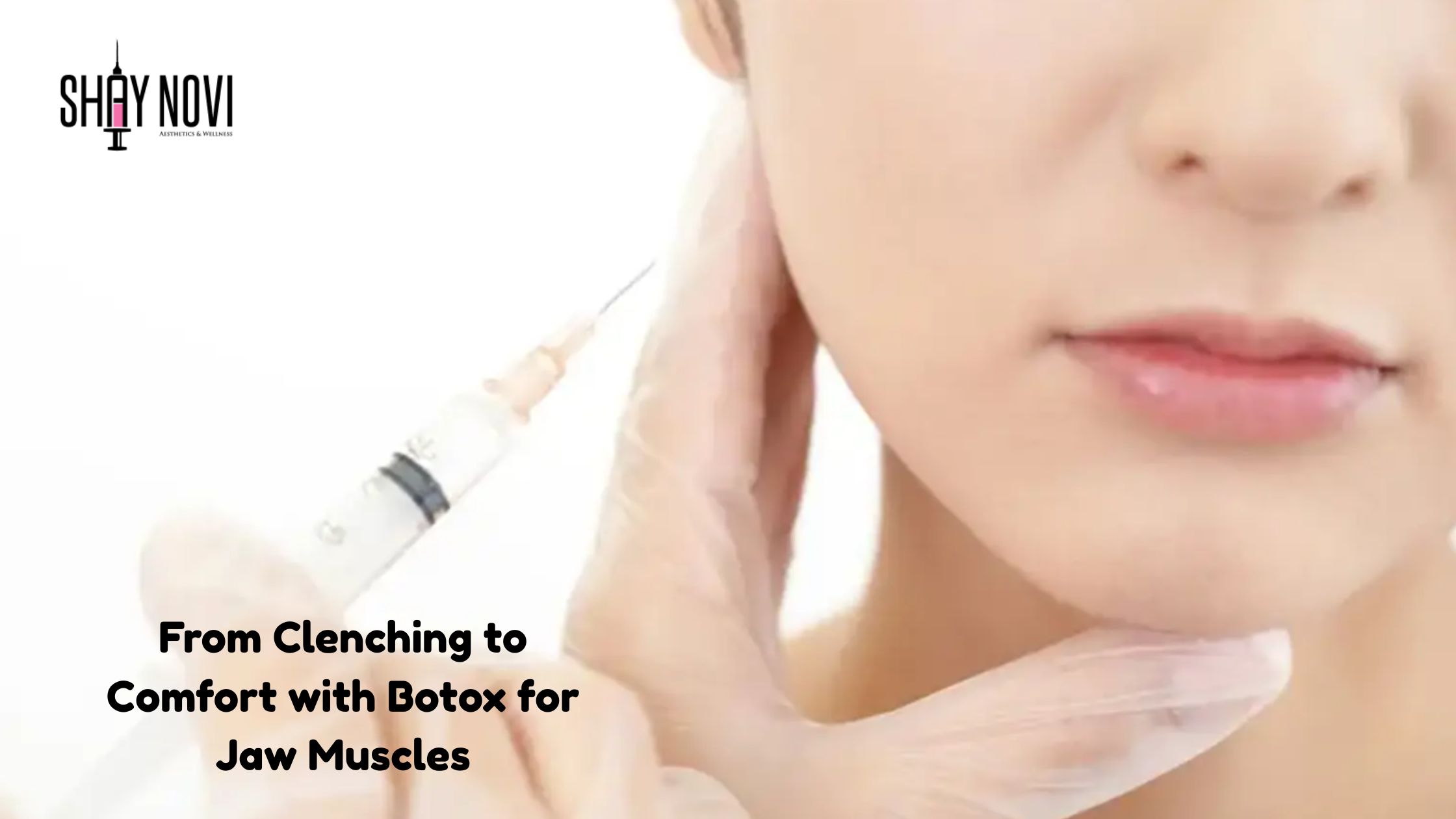 botox for jaw muscles