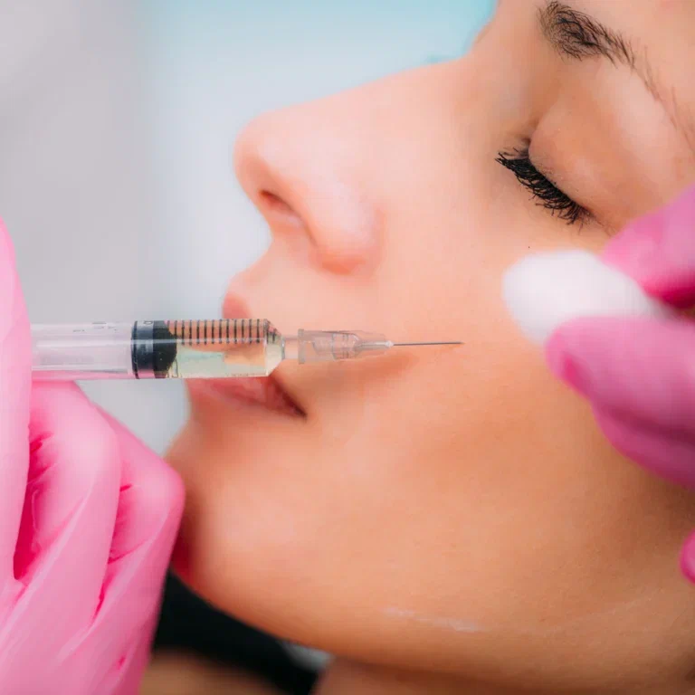 Dermal Fillers in Dubai for Cheek Volume Restoration Dermal fillers in Dubai