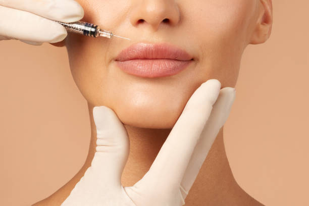 Volbella Fillers in Dubai