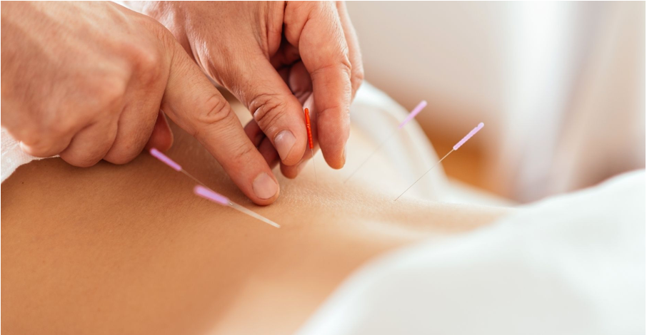 Acupuncture and Fertility: Your Natural Path to Parenthood at Sage Wellness Acupuncture and Fertility